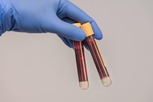 Zwei Laborröhrchen mit Blutproben